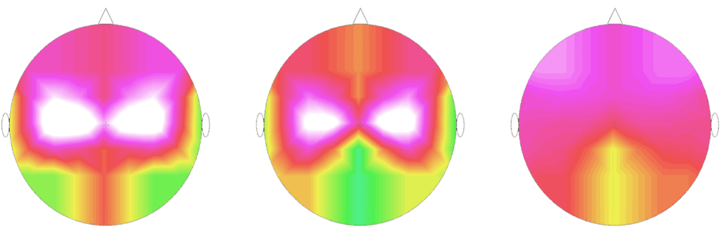 The Harlequin Experience